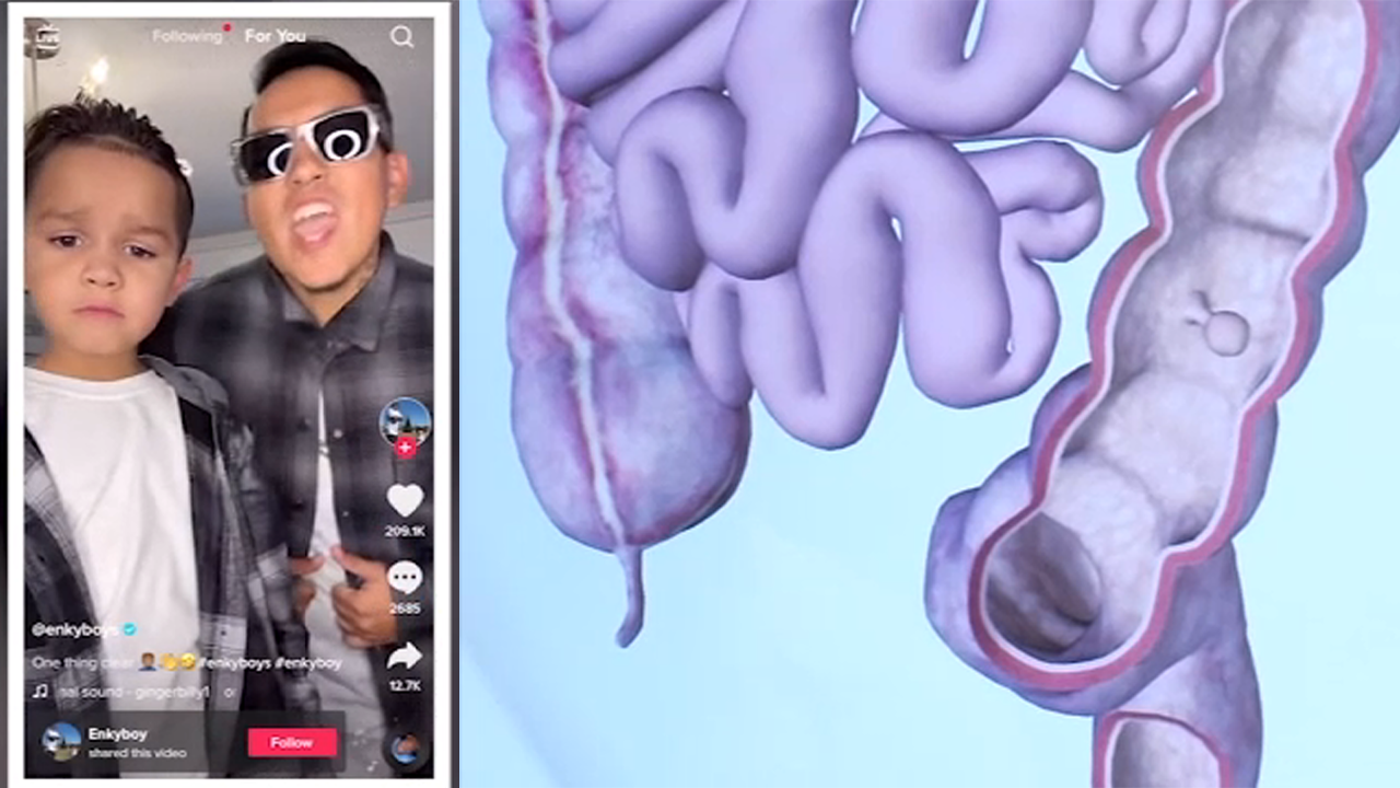 Debunking the TikTok Colon Cleansing Craze and What Doctors Want You to Know | 041622 ktrk splt tm cancer tik tok 041622 ktrk splt tm cancer tik tok | Debunking the TikTok Colon Cleansing Craze and What Doctors Want You to Know